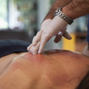 MAJADAHONDA, MADRID, SPAIN - MAY 14. Physiotherapist Sergio Perdiguero perfoms a deep-tissue therapeutical massage at the home of the patient Virginia Bejar, the photographer's partner, using gloves and face masks for protection during the Covid-19 lockdown on May 14, 2020, in Majadahonda, Madrid, Spain. Some parts of Spain have entered the so-called "Phase One" transition from its coronavirus lockdown, allowing many shops to reopen as well as restaurants who serve customers outdoors. Locations that were harder hit by coronavirus (Covid-19), such as Madrid and Barcelona, remain in a stricter "Phase 0" quarantine. (Photo by MiguelPereira/Getty Images)